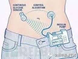 谣言粉碎机 | 人体内安装窃听器的五种可能插图18